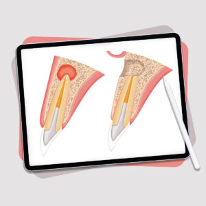 Illustrations dentaires